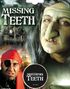 Missing Teeth - Svart Tannfarge